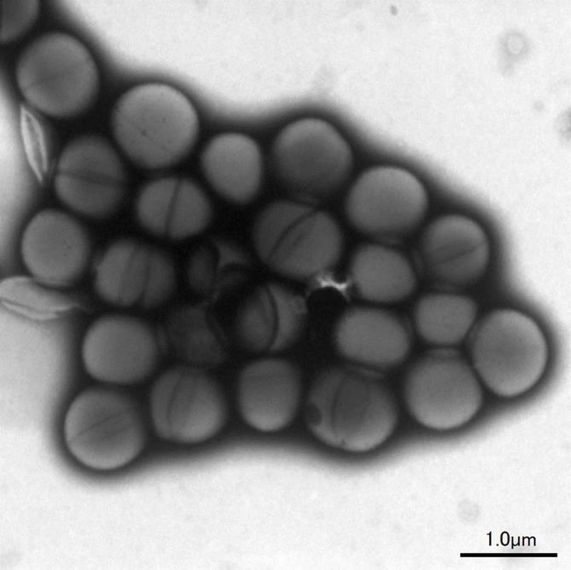 黄色ブドウ球菌（3000倍）の電子顕微鏡写真＝さいたま市健康科学研究センター提供