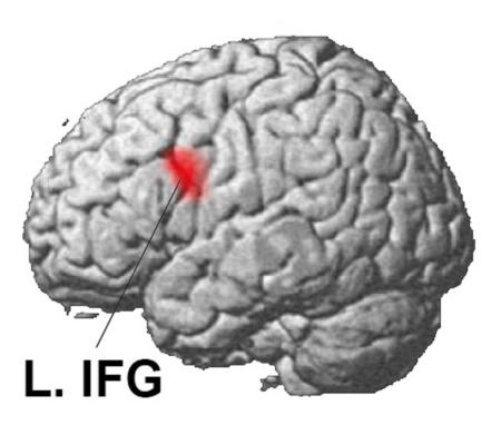 　言語を習得する際に活発に働く脳の領域（左下前頭回を意味する「Ｌ．ＩＦＧ」で示した部分）（酒井邦嘉・東京大教授提供）