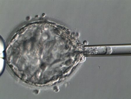 着床前検査のため受精卵から細胞を取り出す様子（慶応大病院提供）