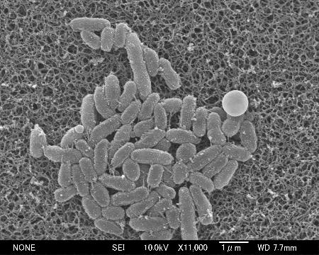 百日ぜき菌の電子顕微鏡画像（国立健康危機管理研究機構提供）