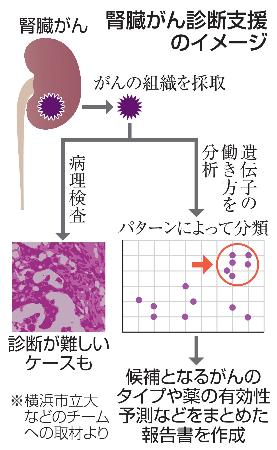 腎臓がん診断支援のイメージ