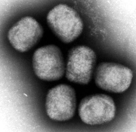 エムポックスウイルスの電子顕微鏡写真(国立感染症研究所提供)