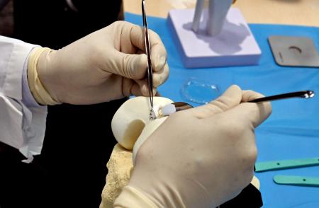 培養軟骨を膝の関節に移植する手術を再現した様子＝２２日、東京都中央区