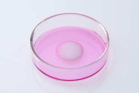 患者の膝の軟骨細胞を培養して移植する再生医療等製品「ジャック」(ジャパン・ティッシュエンジニアリング提供)