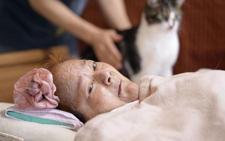 自宅のベッドで過ごす西スミ子さん。旧優生保護法下で強制不妊手術を受けた＝２０２３年６月、東京都日野市