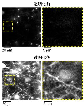 観察したマウスの大脳皮質（九州大稲垣成矩助教、今井猛主幹教授提供）