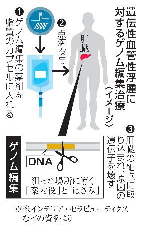 遺伝性血管性浮腫に対するゲノム編集治療（イメージ）