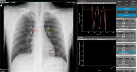 研究グループが公開した研究機での解析の様子（コニカミノルタ提供）