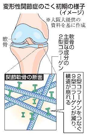 変形性関節症のごく初期の様子（イメージ）